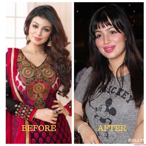 ayesha takia before surgery